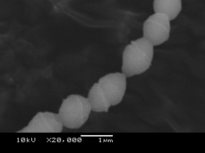 A群溶血性連鎖球菌の電子顕微鏡写真 その１