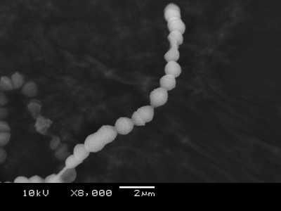 A群溶血性連鎖球菌の電子顕微鏡写真 その２