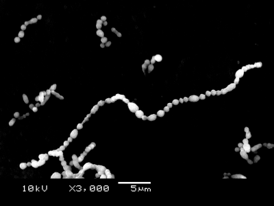 A群溶血背連鎖球菌の電子顕微鏡写真 その３